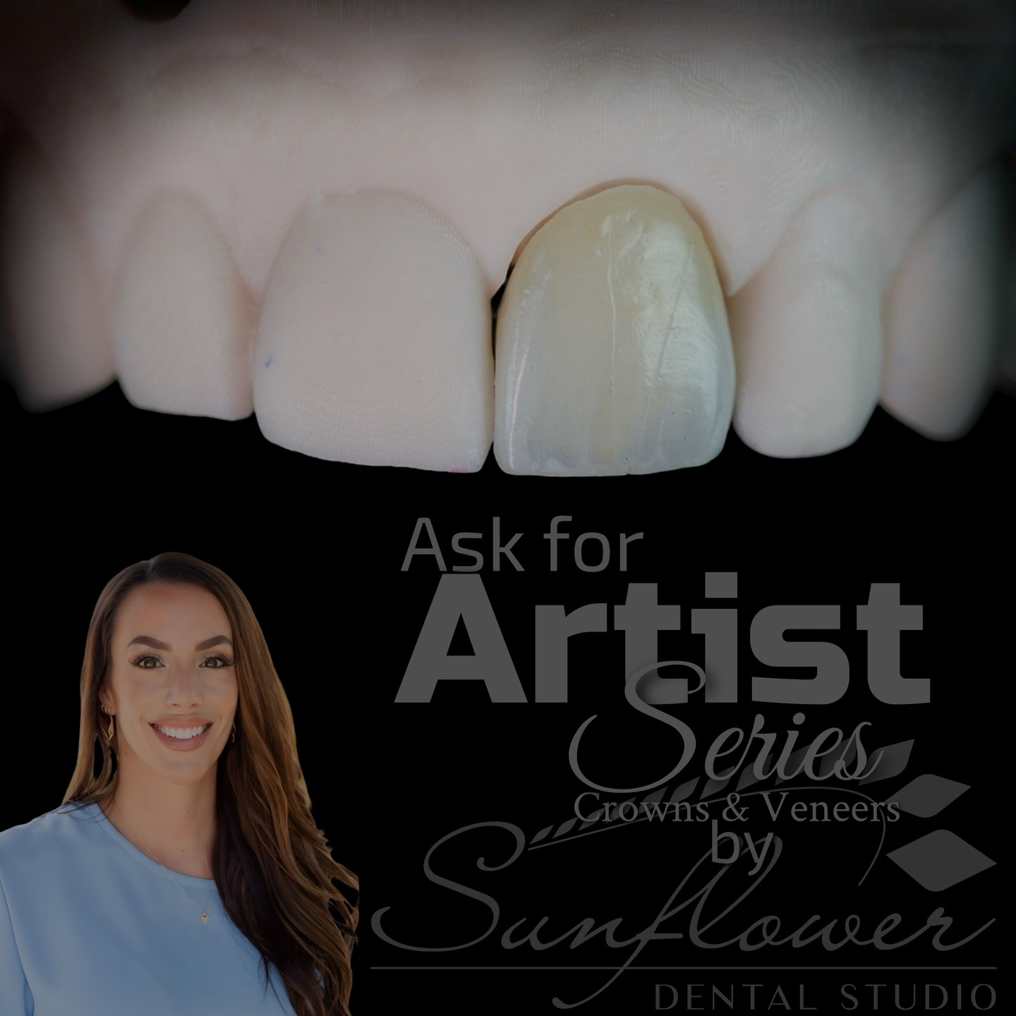 Post by sunflower_dental_studio