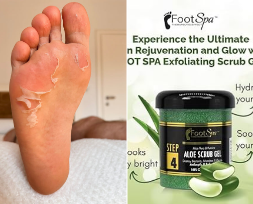 🦶 Top At-Home Foot Peels You’ll Love cover photo collage