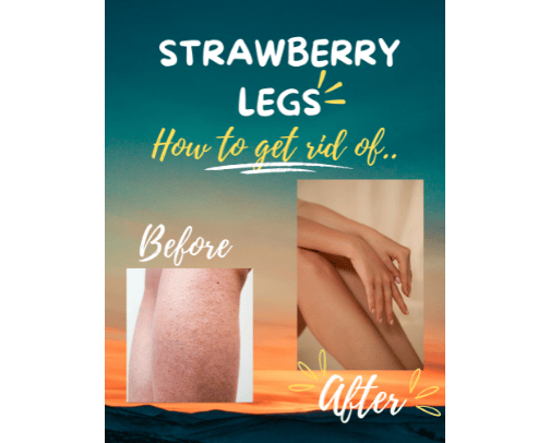 ✨ HOW TO GET RID OF STRAWBERRY LEGS ✨(within two weeks) cover photo collage