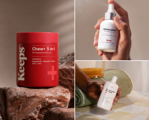Keep your hair and your confidence. Men's Hair Loss treatment. cover photo collage