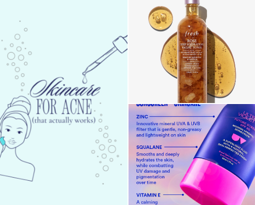 Skincare for Acne—That Actually Works cover photo collage