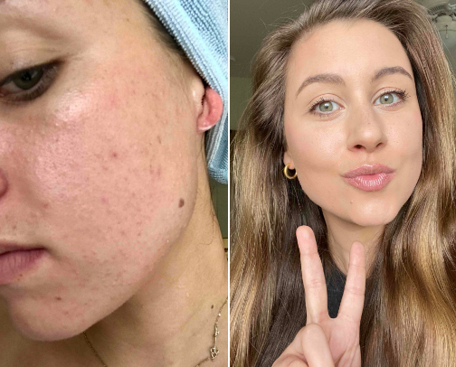 Skincare that WORKS 🧖‍♀️🫧 cover photo collage