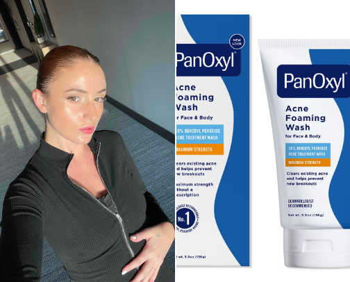 Acne free glowly skincare for the low maintenance girly on a budget cover photo collage