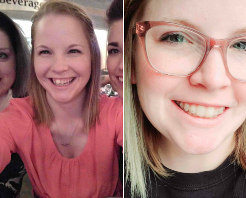 The Ultimate Clean: My Go-To Routine for Clear Aligners (and NO Stains!) cover photo collage