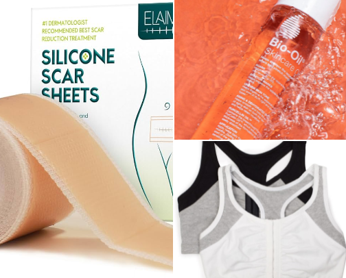 Breast Reduction Recovery cover photo collage