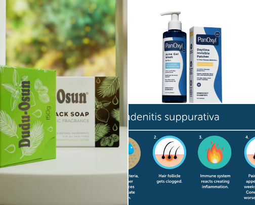 Hidradenitis suppurativa cover photo collage