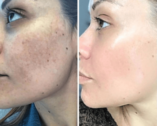 dark circles,acne spots,scars solutions cover photo collage
