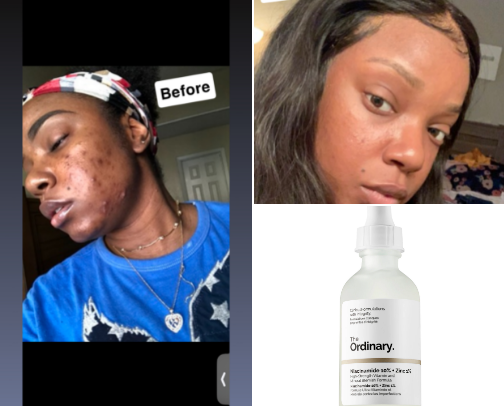 Textured skin MAGIC MUST HAVES✨ cover photo collage