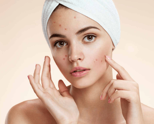 Face inperfection top products cover photo collage