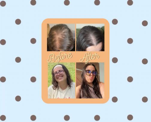 The Hair Routine That Helped Me Grow Half My Hair Back cover photo collage