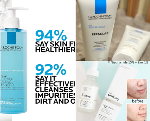 Best Skincare for Oily & Acne-Prone Skin ✨ cover photo collage