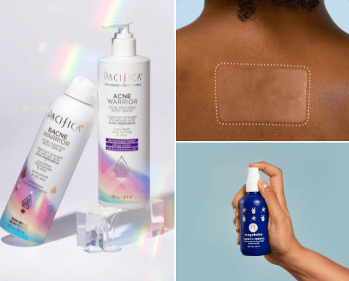 BODY/CHEST acne & dark spots MUST HAVES! 🧴 cover photo collage