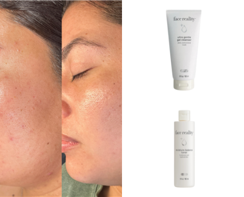 Face Reality Products That Got My Skin Clear cover photo collage