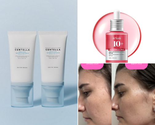 Took my skin from 💀 to ☀️ cover photo collage