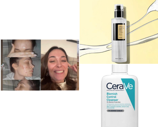 Makeup & Skincare That’s Actually Saving My Skin as a New Mum (Acne-Prone Edition) cover photo collage