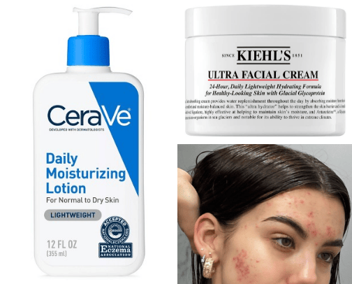 Products that saved my ance prone skin in less than two months:) cover photo collage
