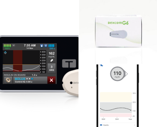 Type 1 diabetes medical supplies cover photo collage