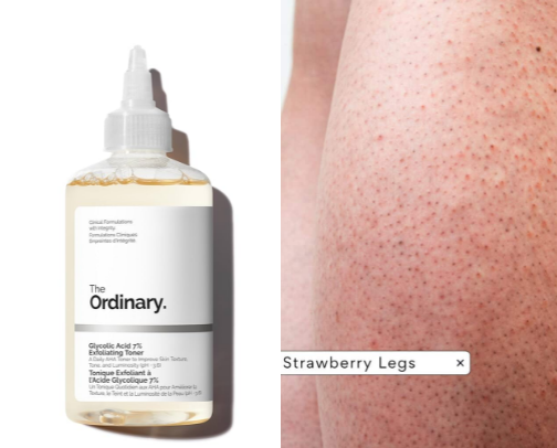 Bye-Bye Strawberry Legs! cover photo collage