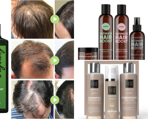 Stop Hair Loss cover photo collage