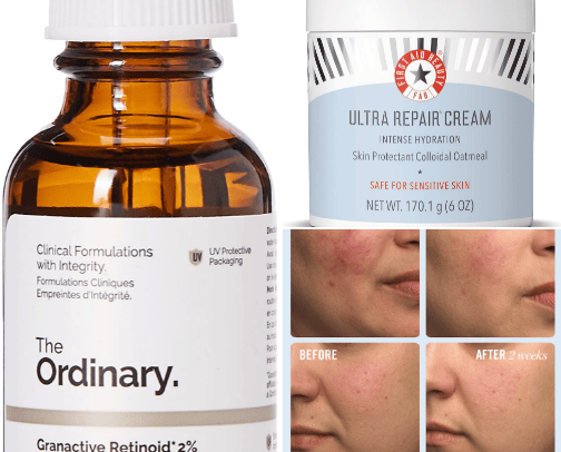 Products for dry skin🎀 cover photo collage