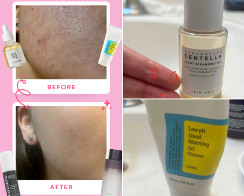 Products That ✨HEALED✨My Skin 😍 cover photo collage