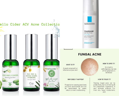 Malassezia-Friendly Skincare Essentials/Barrier–Safe Picks (FA-Safe) cover photo collage