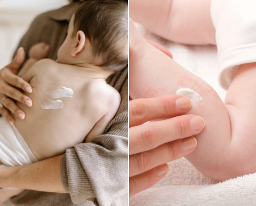 Skincare Bayi yang Aman untuk Newborn cover photo collage