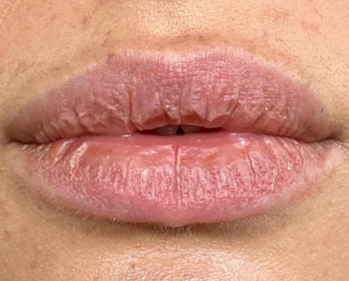 best lip products for lips prone to chapping, drying, and cracking👄 cover photo collage