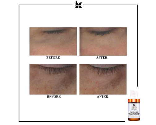 Must TRIES-Under Eye Repair & Care cover photo collage