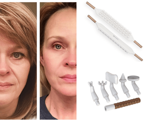 Must Have Tools For Fascia Health & Cellulite cover photo collage