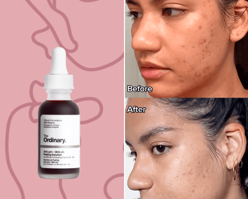 Skin care but on a ✨budget✨ cover photo collage