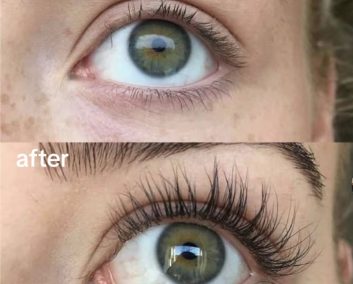 Lash serum🤍 cover photo collage