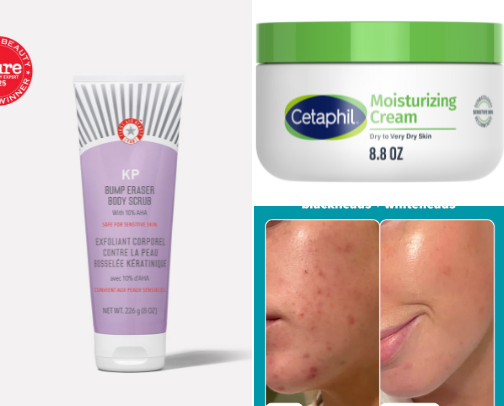 My DRY skin routine - face&body essentials cover photo collage