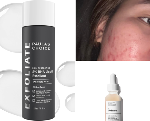 Gentle Exfoliators That Actually Cleared My Clogged Pores in Weeks cover photo collage
