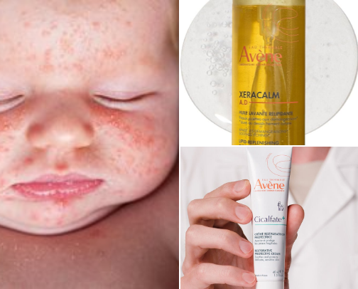 Im a Mom. Mommy? Mamacita 👶: Baby Skin Care cover photo collage