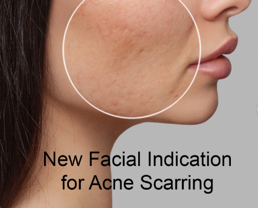 5-Step Skincare Routine for Smooth and Glowing Skin cover photo collage