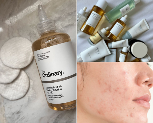 Acne-prone skin makeup products cover photo collage