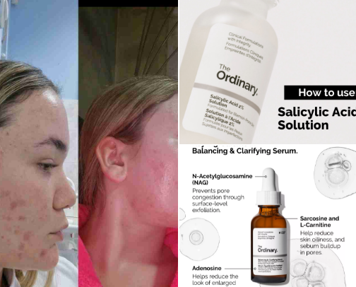 "The Ordinary" or the savior of my skin (synonyms for me)! cover photo collage