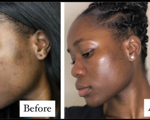 Get that glass SKIN ✨ cover photo collage