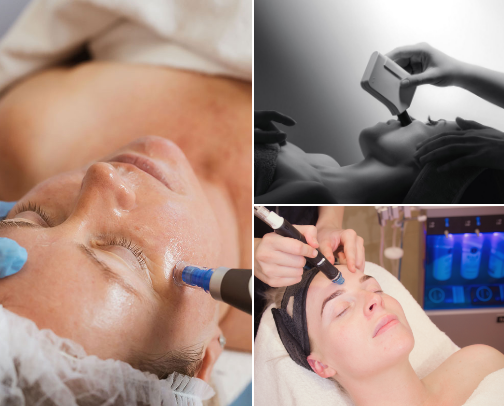 Skin Treatments That Will Change Your Life! cover photo collage