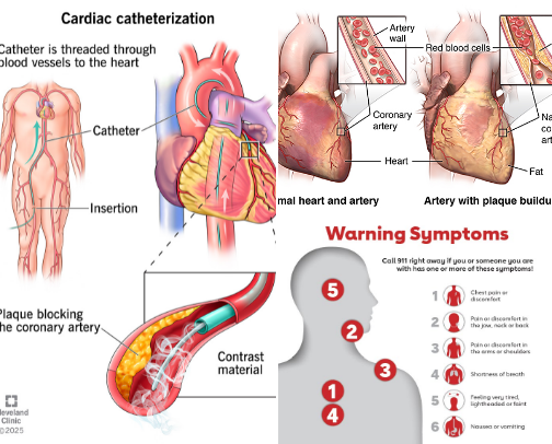 Heart Attack Symptoms in Women- THIS IS IMPORTANT INFORMATION cover photo collage