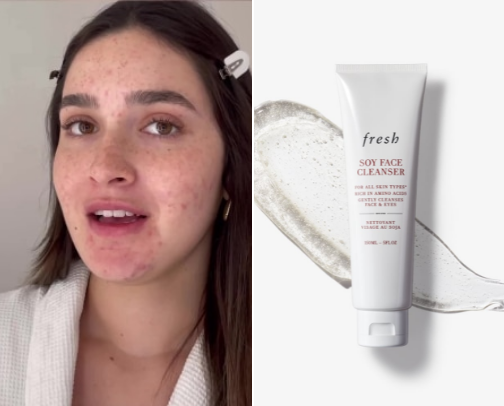 Best skincare for hydrating and glowing skin cover photo collage