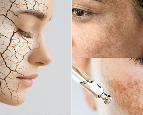 🩶 Deep Hydration: Expert Routine for Dry & Dehydrated Skin🩶 cover photo collage