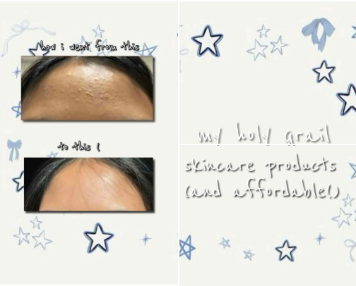 the skincare that cleared up my acne ! cover photo collage