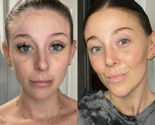 Simple skincare routine for glowy, clear, hydrated skin ✨🧖🏼‍♀️ cover photo collage