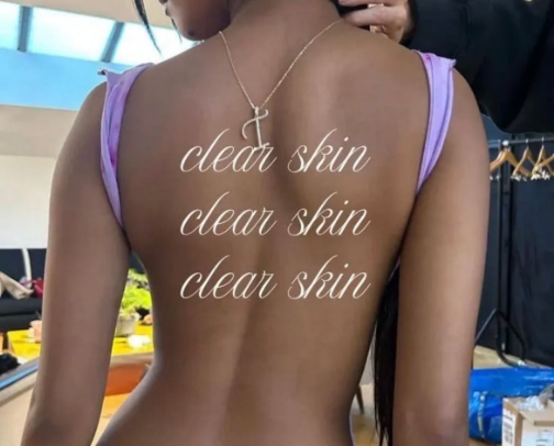 Back Acne SOS ♡ cover photo collage