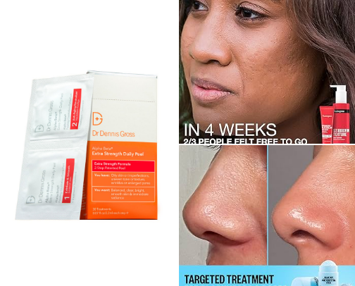 Blackhead Removers for Clearer Skin cover photo collage