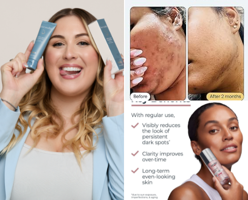Acne but my derm appt's in 6 months cover photo collage