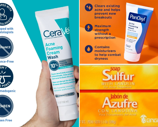 Acne but my derm appt's in 6 months cover photo collage