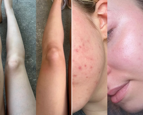 bodycare and skincare i recommend that i use and never change brand cover photo collage